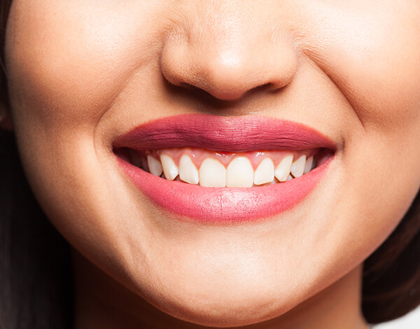 Cosmetic Dentistry
