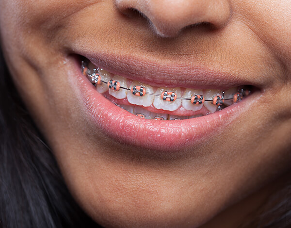 Orthodontics
